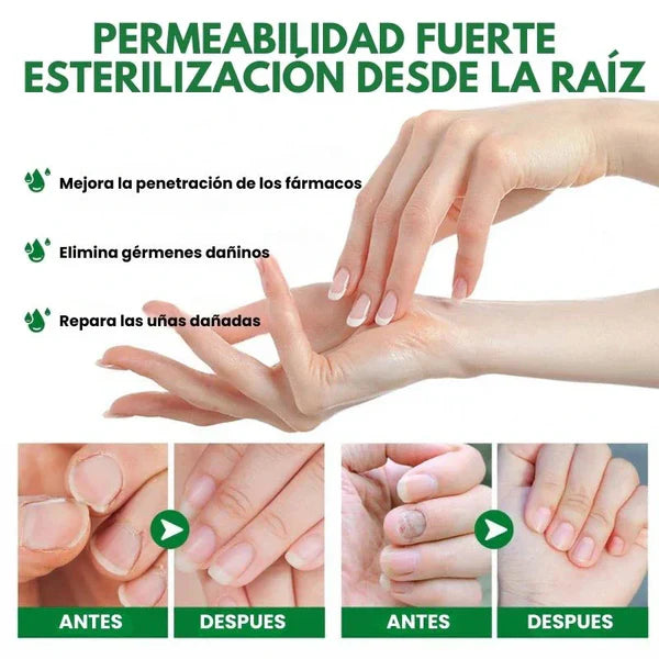 Compra 1 y llevate 2👋🦠 Antifúngico para Unhas - 7 Days™ 2UNID 30ml