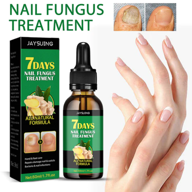 Compra 1 y llevate 2👋🦠 Antifúngico para Unhas - 7 Days™ 2UNID 30ml