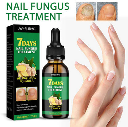 Compra 1 y llevate 2👋🦠 Antifúngico para Unhas - 7 Days™ 2UNID 30ml