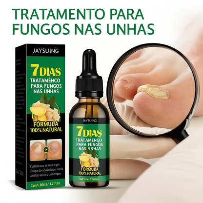 Compra 1 y llevate 2👋🦠 Antifúngico para Unhas - 7 Days™ 2UNID 30ml