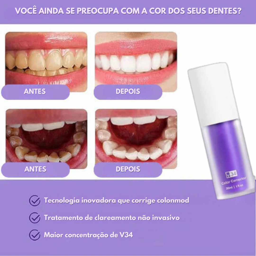 Ultra Branqueador Dental - BrancoMax 🦷