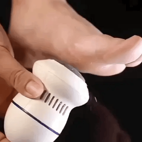 Removedor Eléctrico de Calos