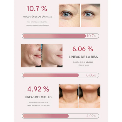 Compra 1 y llevate 2 O'Cheal - Bálsamo hidratante Anti-líneas de expresión - 2X1